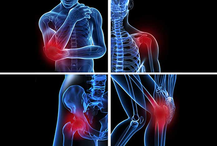 What is Bursitis? - O-health